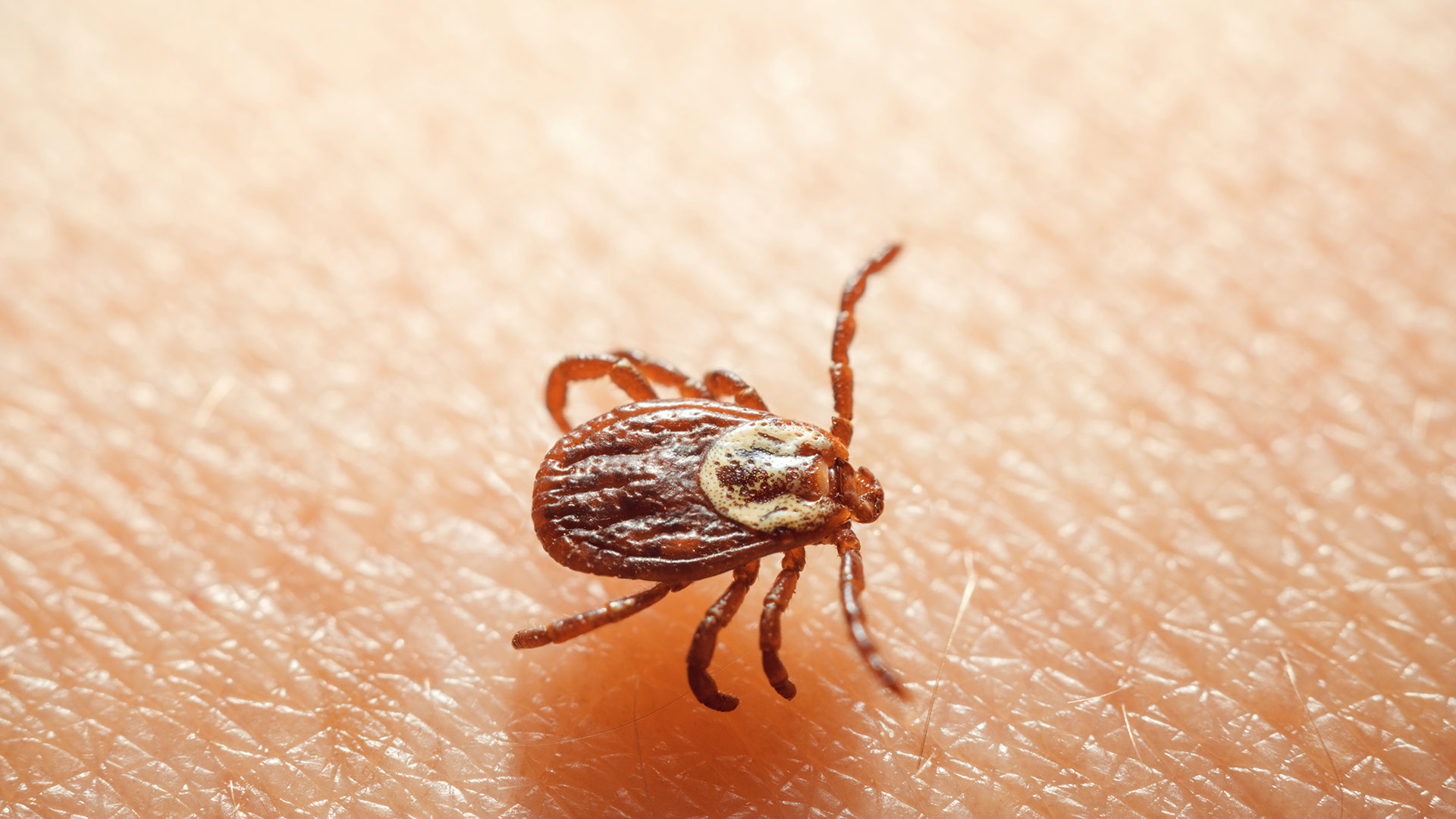 A tick crawling on a person's skin in Mankato, MN.